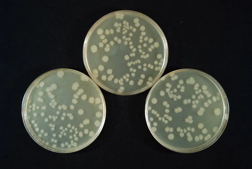 大腸菌生育状況