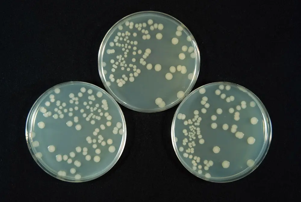 大腸菌生育状況